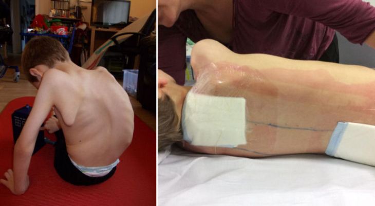 Back - Before and After